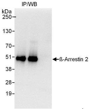 Rabbit anti-Beta-Arrestin 2 Antibody