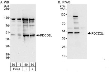 Rabbit anti-PDCD2L Antibody