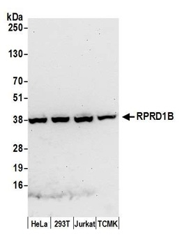 Rabbit anti-RPRD1B Antibody