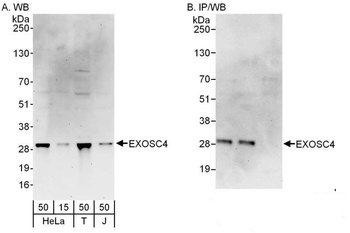 Rabbit anti-EXOSC4 Antibody