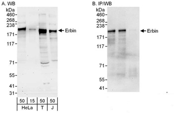 Rabbit anti-Erbin Antibody