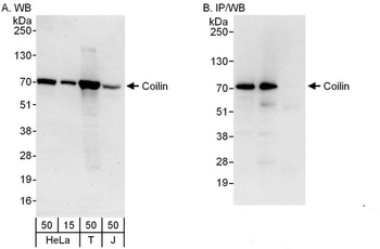 Rabbit anti-Coilin Antibody