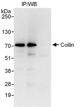 Rabbit anti-Coilin Antibody