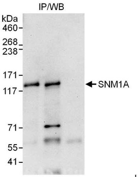 SNM1A Antibody