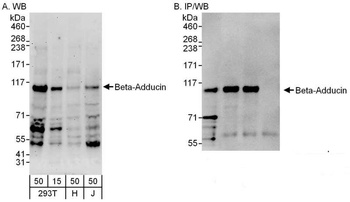 Beta-Adducin Antibody