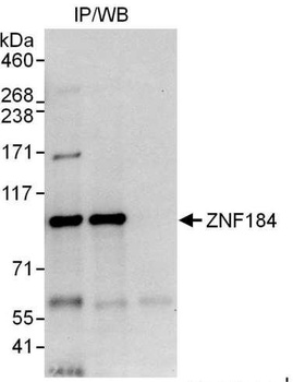 Rabbit anti-ZNF184 Antibody