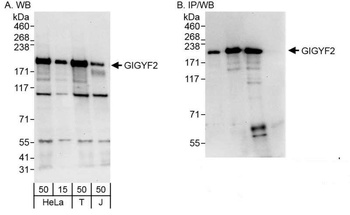 Rabbit anti-GIGYF2 Antibody