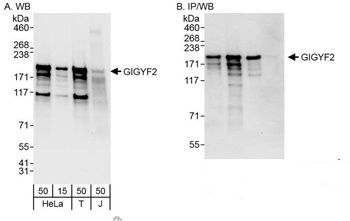 Rabbit anti-GIGYF2 Antibody