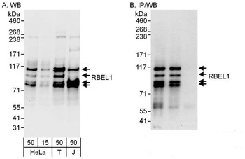 RBEL1 Antibody