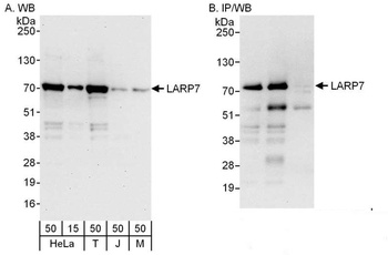LARP7 Antibody