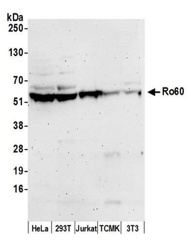 Ro60 Antibody