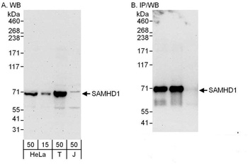 Rabbit anti-SAMHD1 Antibody