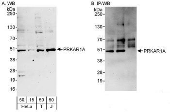 Rabbit anti-PRKAR1A Antibody