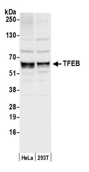 TFEB Antibody