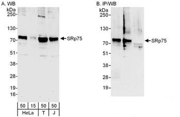 Rabbit anti-SRp75 Antibody