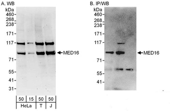 MED16 Antibody