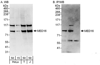Rabbit anti-MED16 Antibody