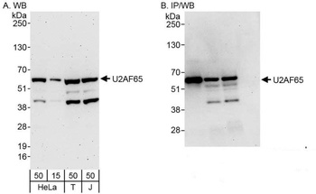 Rabbit anti-U2AF65 Antibody