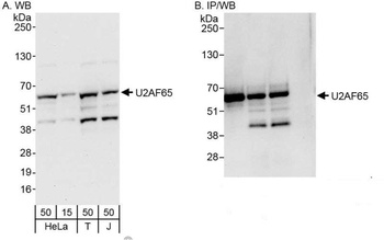 Rabbit anti-U2AF65 Antibody