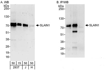 SLAIN1 Antibody