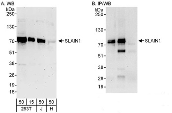 Rabbit anti-SLAIN1 Antibody