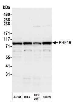 Rabbit anti-PHF16 Antibody
