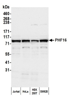 PHF16 Antibody