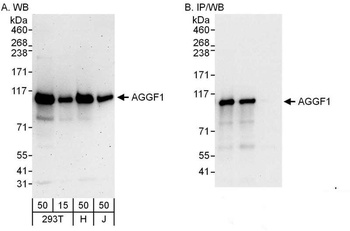 Rabbit anti-AGGF1 Antibody