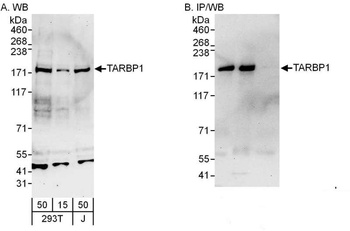 Rabbit anti-TARBP1 Antibody