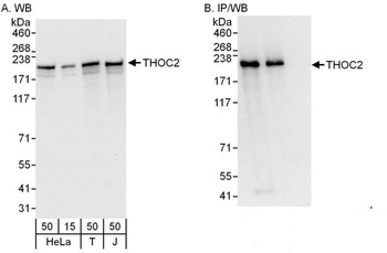 Rabbit anti-THOC2 Antibody
