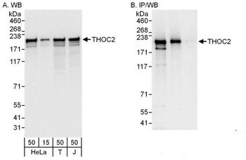 Rabbit anti-THOC2 Antibody