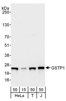 Rabbit anti-GSTP1 Antibody