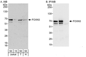 Rabbit anti-FOXN3 Antibody