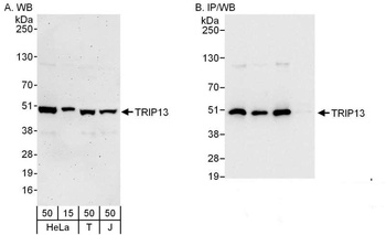 Rabbit anti-TRIP13 Antibody