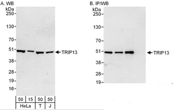 Rabbit anti-TRIP13 Antibody