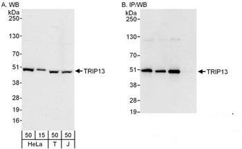 Rabbit anti-TRIP13 Antibody