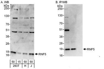 Rabbit anti-RNF5 Antibody