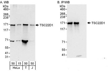 TSC22D1 Antibody