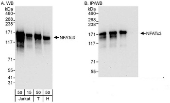 NFATc3 Antibody