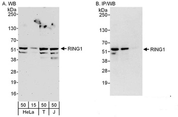 Rabbit anti-RING1 Antibody