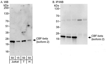 CBF-beta (isoform 2) Antibody