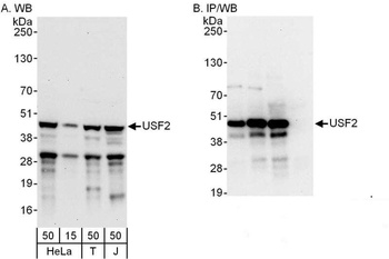 Rabbit anti-USF2 Antibody