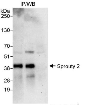 Sprouty 2 Antibody