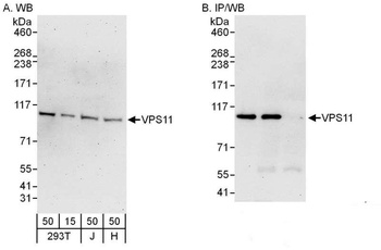 VPS11 Antibody