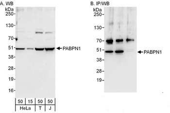 Rabbit anti-PABPN1 Antibody
