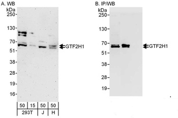 GTF2H1 Antibody