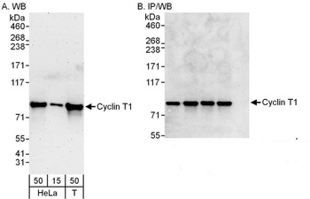 Rabbit anti-Cyclin T1 Antibody