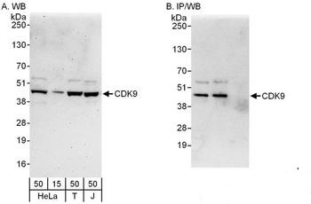 Rabbit anti-CDK9 Antibody