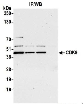 Rabbit anti-CDK9 Antibody