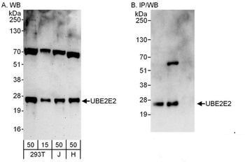 UBE2E2 Antibody